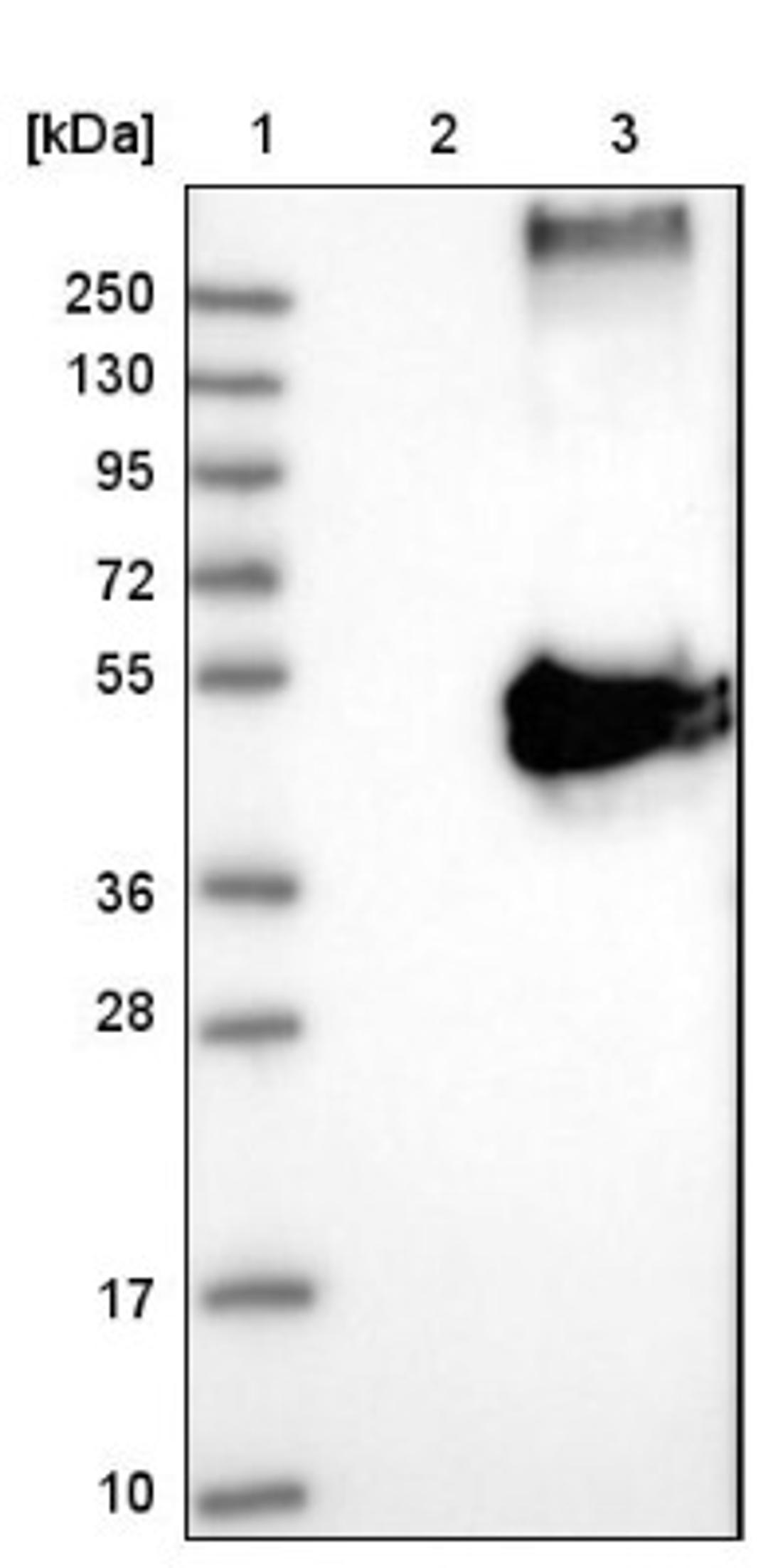 Western Blot: WDR4 Antibody [NBP1-86901] - Lane 1: Marker [kDa] 250, 130, 95, 72, 55, 36, 28, 17, 10<br/>Lane 2: Negative control (vector only transfected HEK293T lysate)<br/>Lane 3: Over-expression lysate (Co-expressed with a C-terminal myc-DDK tag (~3.1 kDa) in mammalian HEK293T cells, LY403257)