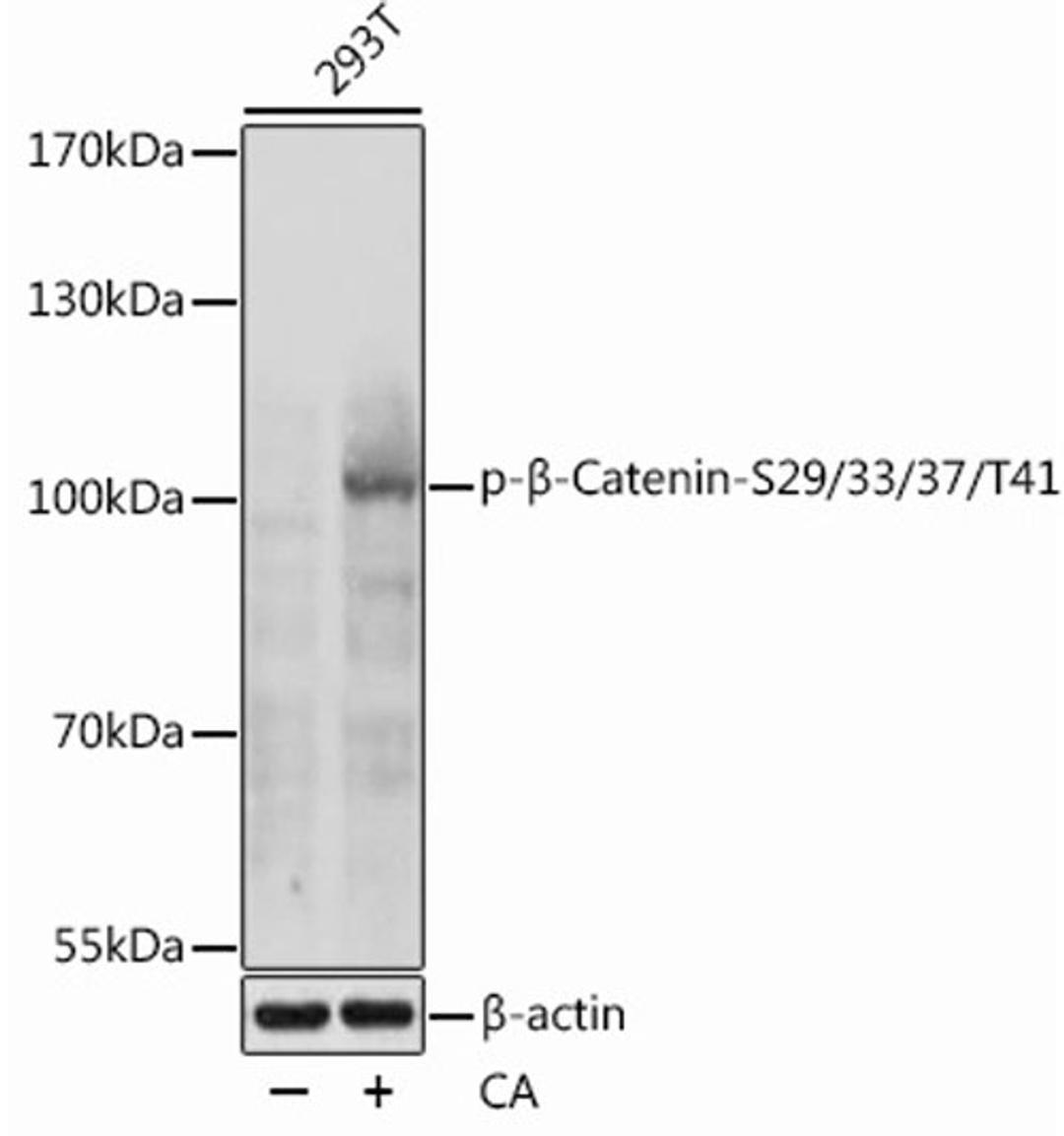 Western blot - Phospho-ß-Catenin-S29/33/37/T41 antibody (AP1076)