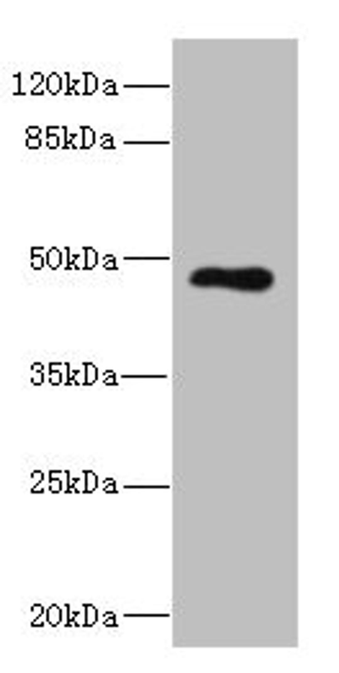 Western blot. All lanes: KIR3DL3 antibody at 1.75µg/ml + Jurkat whole cell lysate. Secondary. Goat polyclonal to rabbit IgG at 1/10000 dilution. Predicted band size: 45 kDa. Observed band size: 45 kDa