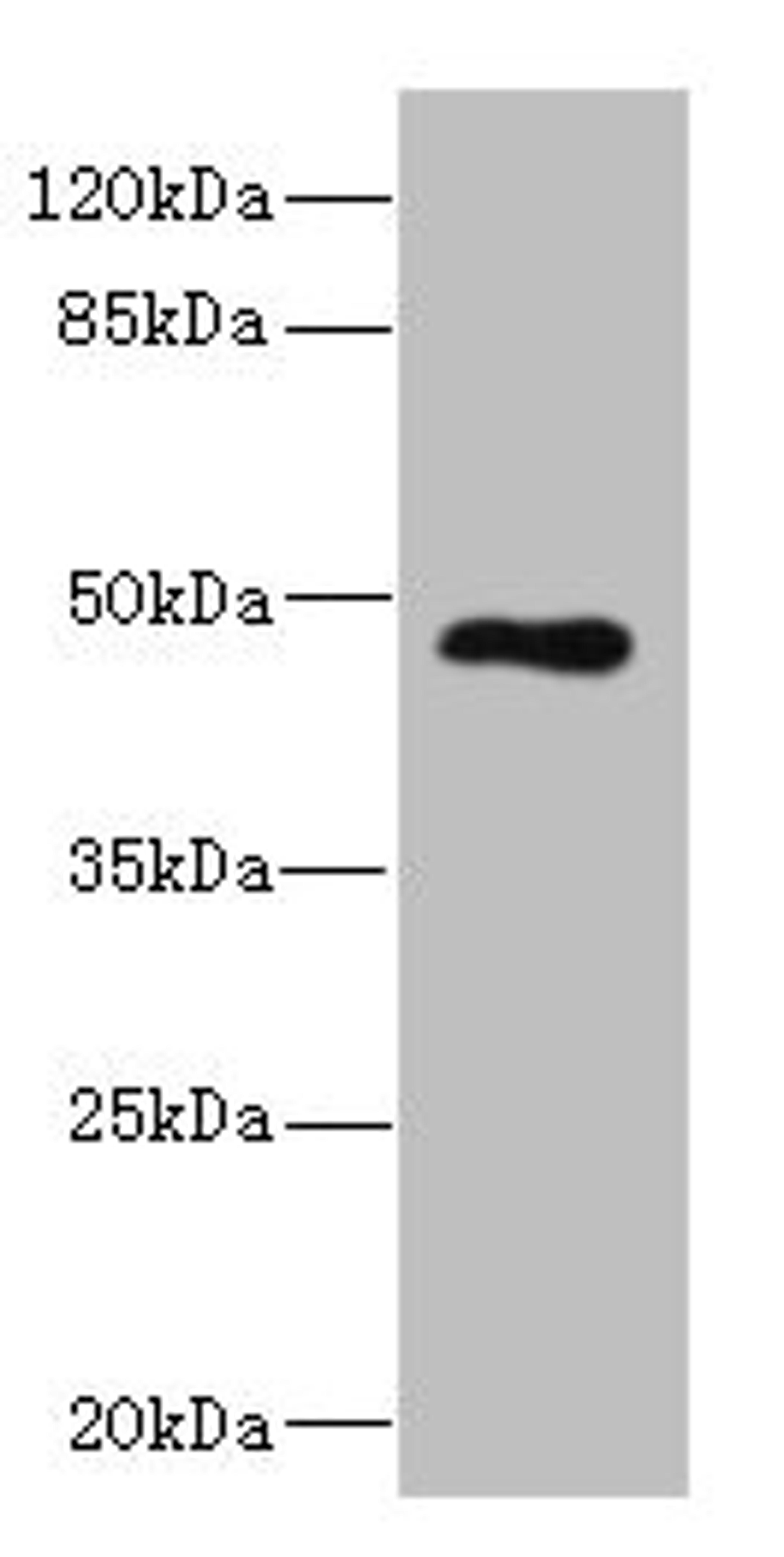 Western blot. All lanes: KIR3DL3 antibody at 1.75µg/ml + Jurkat whole cell lysate. Secondary. Goat polyclonal to rabbit IgG at 1/10000 dilution. Predicted band size: 45 kDa. Observed band size: 45 kDa