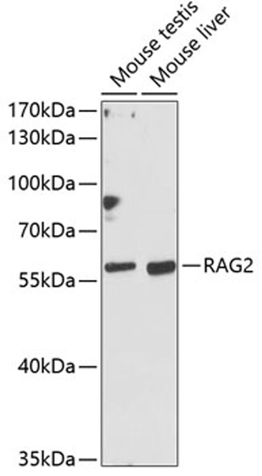 Western blot - RAG2 antibody (A12488)