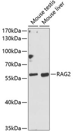 Western blot - RAG2 antibody (A12488)