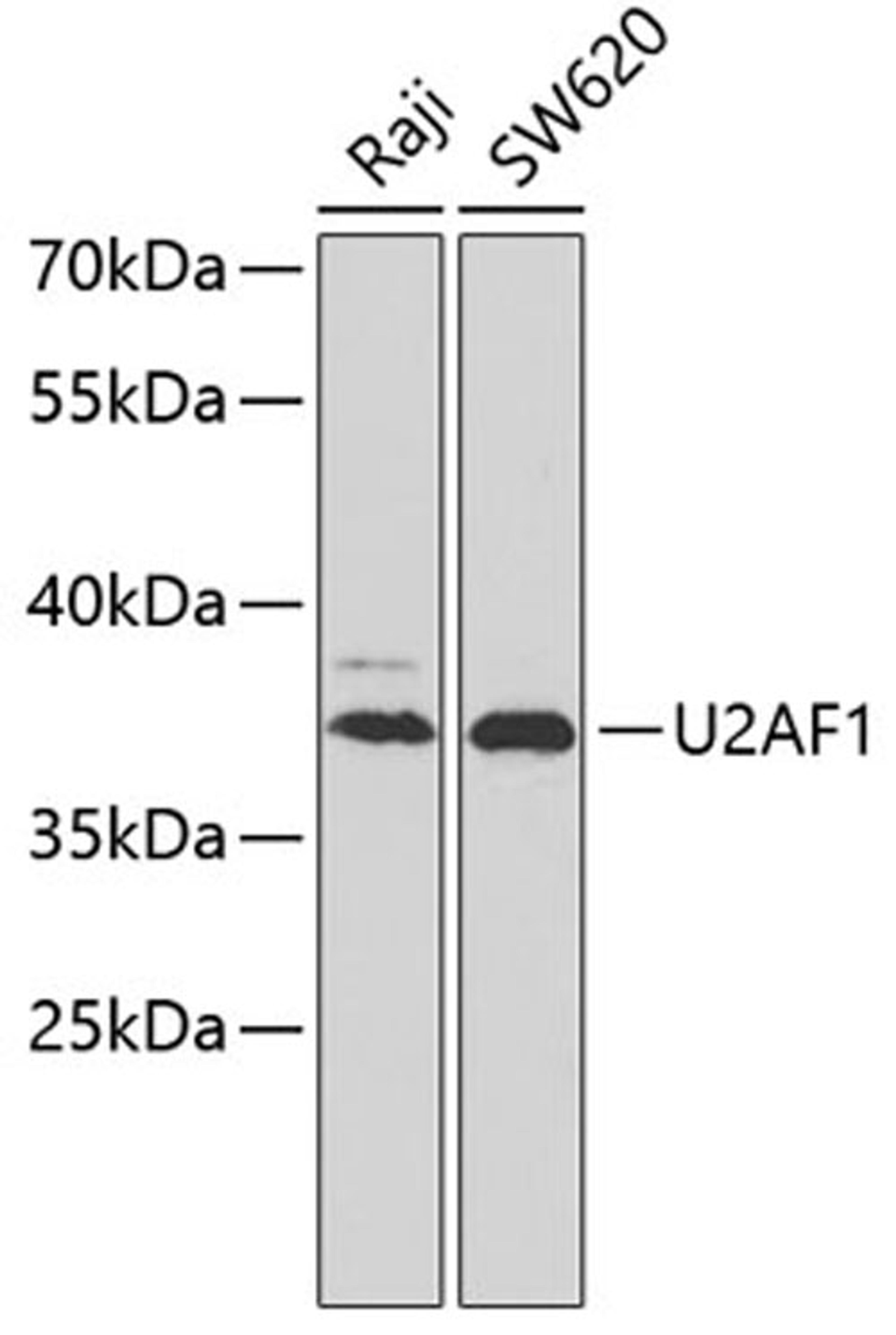 Western blot - U2AF1 antibody (A6076)