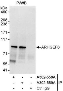 Detection of human ARHGEF6 by western blot of immunoprecipitates.