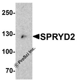 Western blot analysis of SPRYD2 in mouse heart tissue lysate with SPRYD2 antibody at 1 μg/mL.
