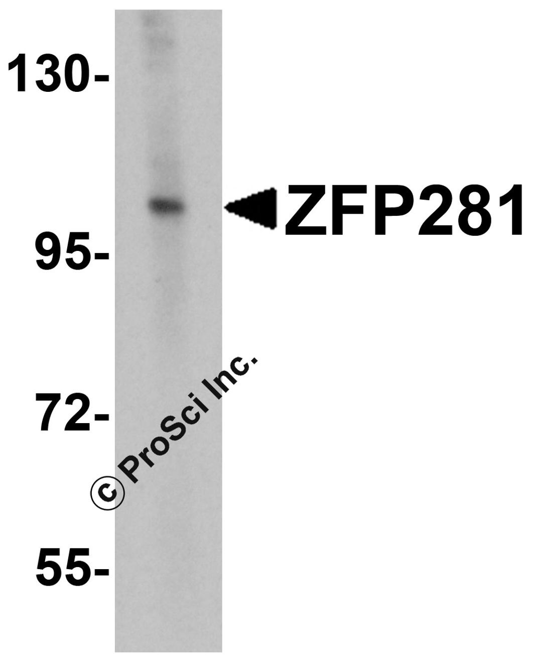 Western blot analysis of ZFP281 in A-20 cell lysate with ZFP281 antibody at 0.5 μg/mL.
