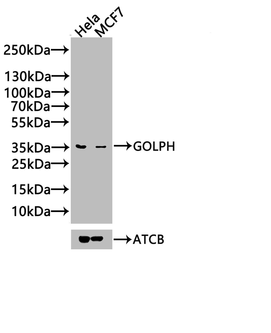 Western Blot. Positive WB detected in: Hela whole cell lysate, 293 whole cell lysate, A549 whole cell lysate. All lanes: GOLPH3 antibody at 3.2µg/ml. Secondary. Goat polyclonal to rabbit IgG at 1/50000 dilution. Predicted band size: 34 kDa. Observed band size: 34 kDa