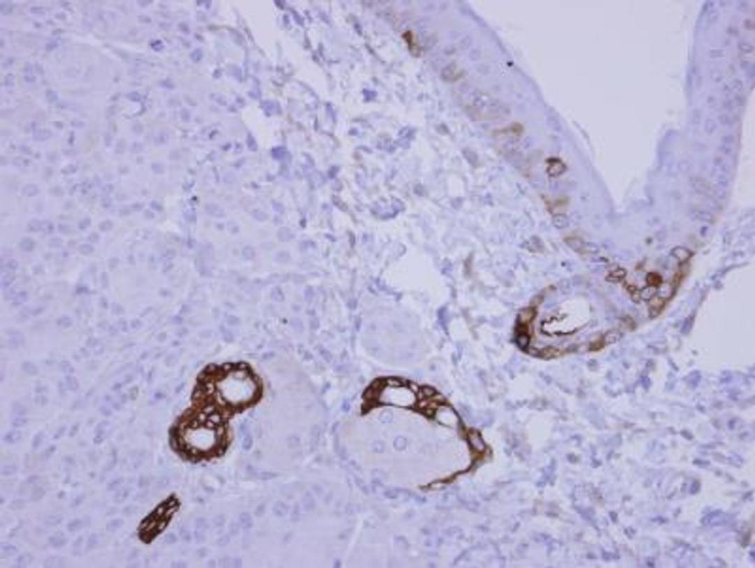 Immunohistochemistry-Paraffin: CXCL13/BLC/BCA-1 Antibody [NBP2-16041] - Cal27 xenograft.