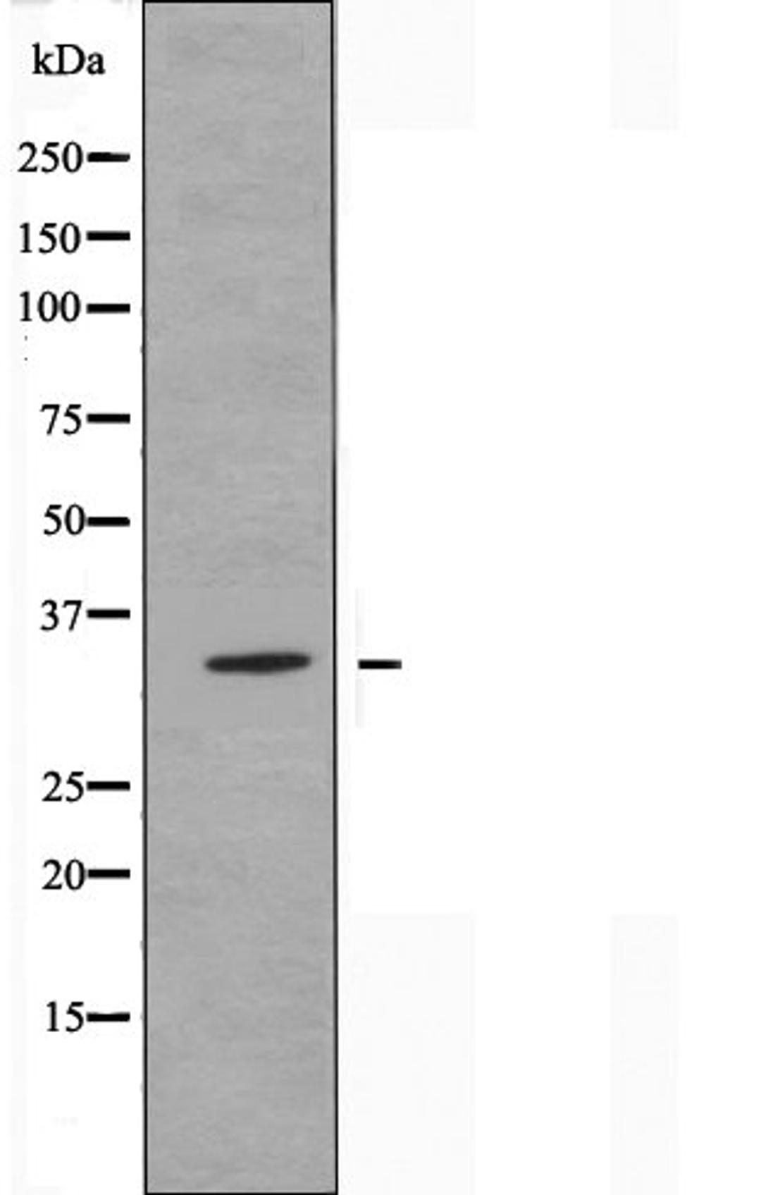 Western blot analysis of LOVO cells using OR13C3 antibody