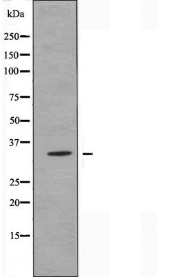 Western blot analysis of LOVO cells using OR13C3 antibody