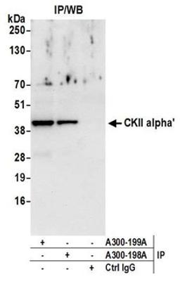 Detection of human CKII alpha' by western blot of immunoprecipitates.