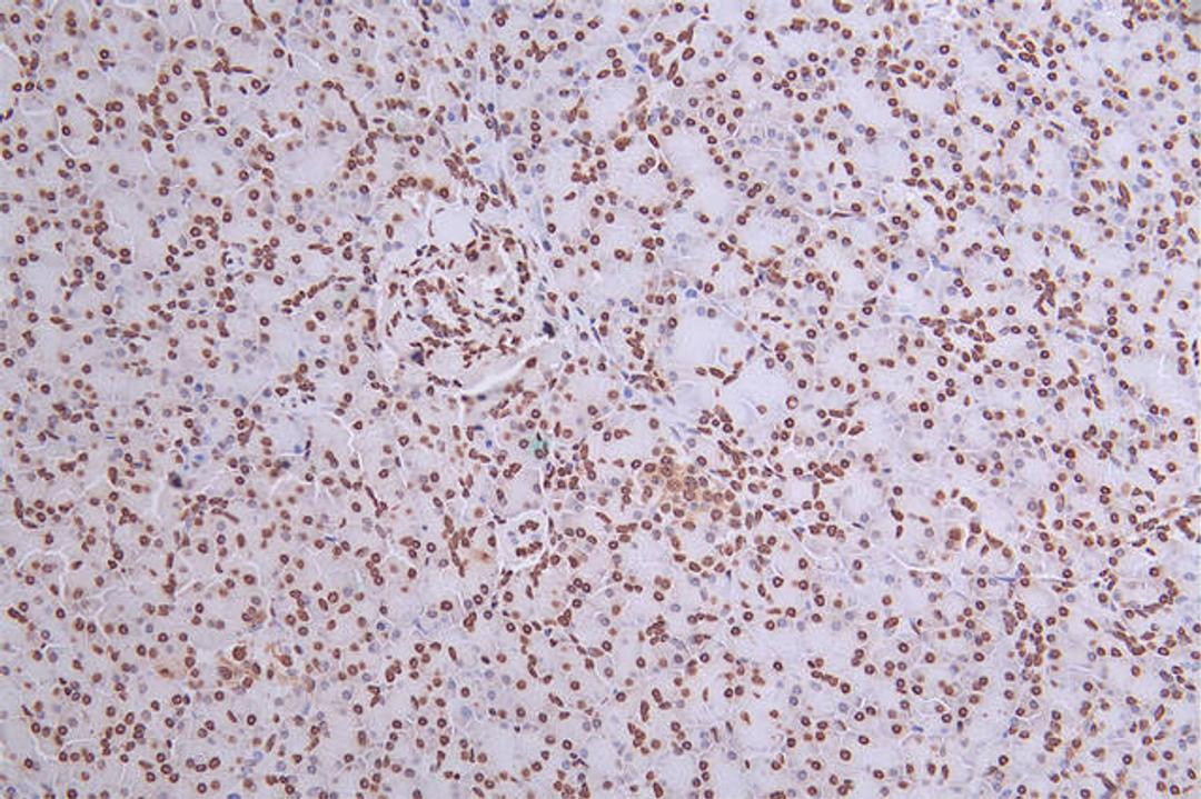 IHC image of CSB-RA034362A0HU diluted at 1:50 and staining in paraffin-embedded human pancreati  tissue performed on a Leica BondTM system. After dewaxing and hydration, antigen retrieval was mediated by high pressure in a citrate buffer (pH 6.0). Section was blocked with 10% normal goat serum 30min at RT. Then primary antibody (1% BSA) was incubated at 4°C overnight. The primary is detected by a Goat anti-rabbit polymer IgG labeled by HRP and visualized using 0.27% DAB.