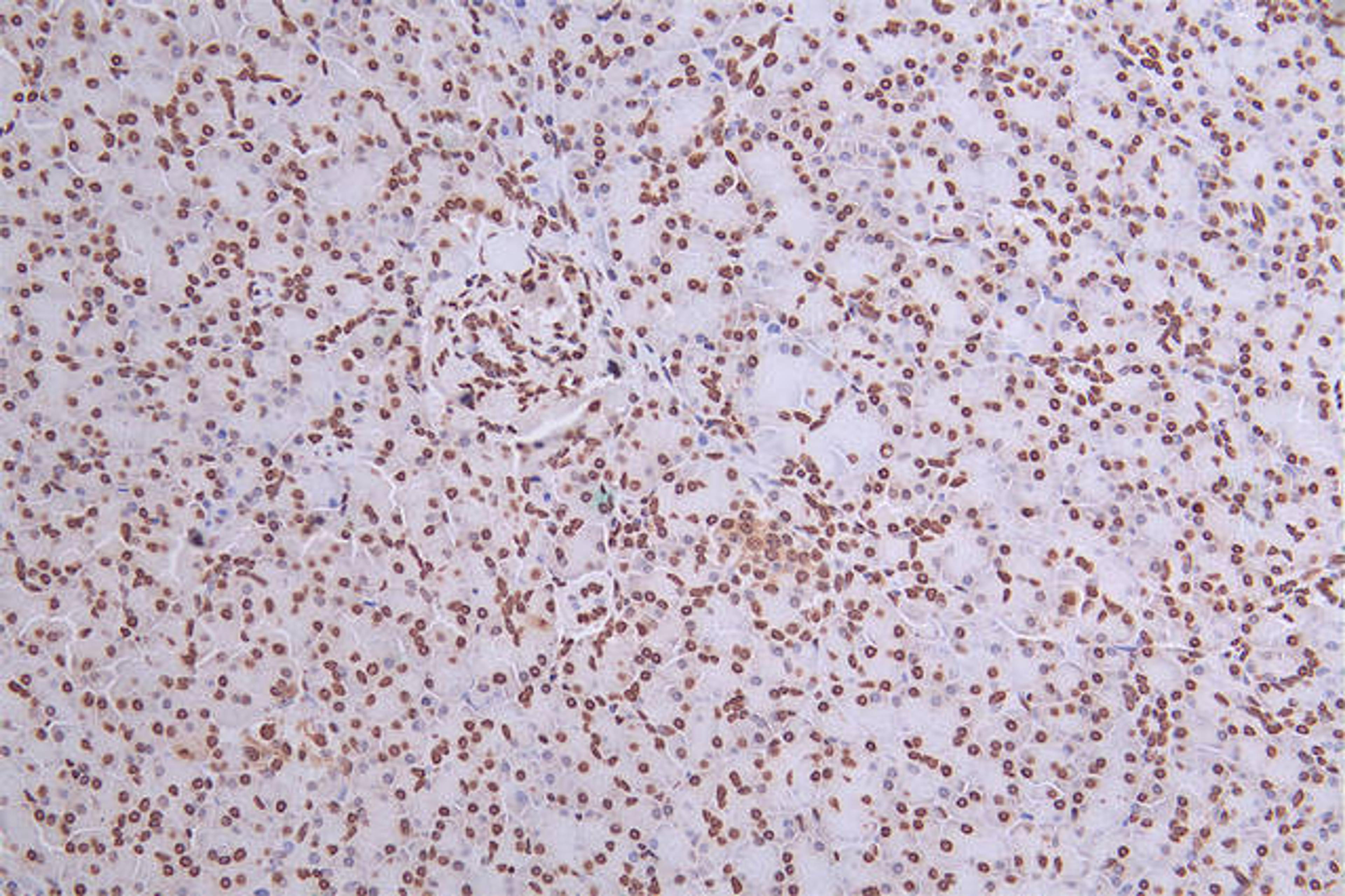 IHC image of CSB-RA034362A0HU diluted at 1:50 and staining in paraffin-embedded human pancreati  tissue performed on a Leica BondTM system. After dewaxing and hydration, antigen retrieval was mediated by high pressure in a citrate buffer (pH 6.0). Section was blocked with 10% normal goat serum 30min at RT. Then primary antibody (1% BSA) was incubated at 4°C overnight. The primary is detected by a Goat anti-rabbit polymer IgG labeled by HRP and visualized using 0.27% DAB.