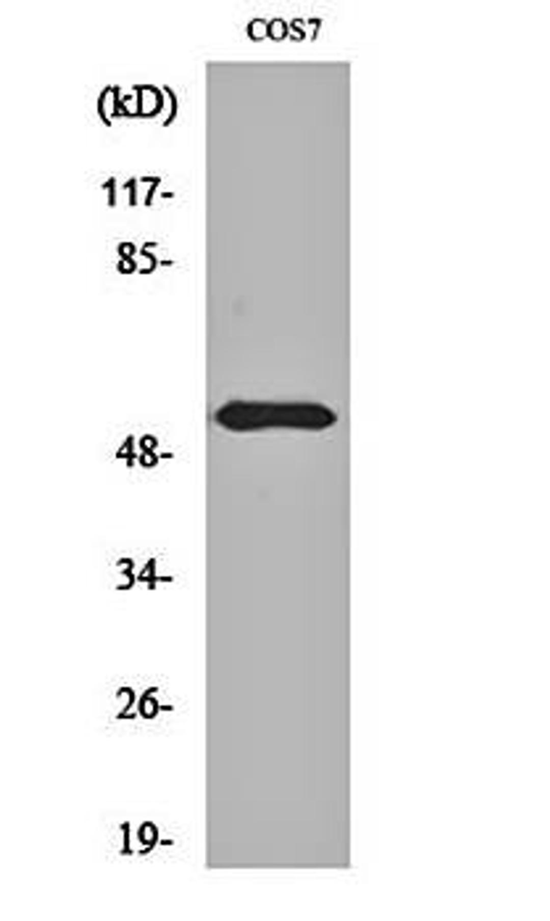 Western blot analysis of 293 cell lysates using EGFR (phospho-T693) antibody