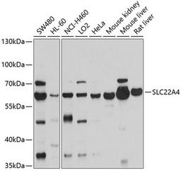 Western blot - SLC22A4 antibody (A10490)