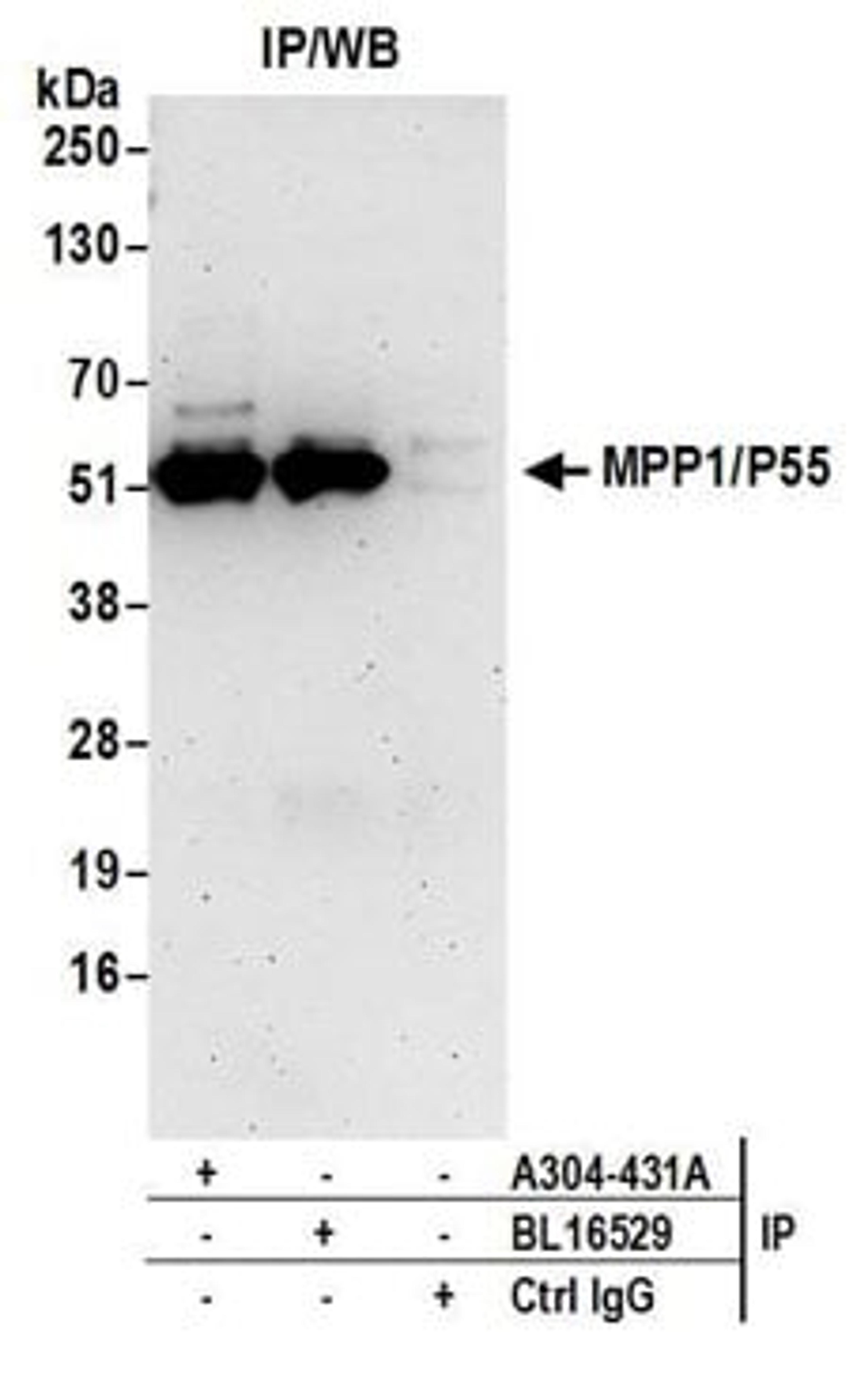 Detection of human MPP1/P55 by western blot of immunoprecipitates.