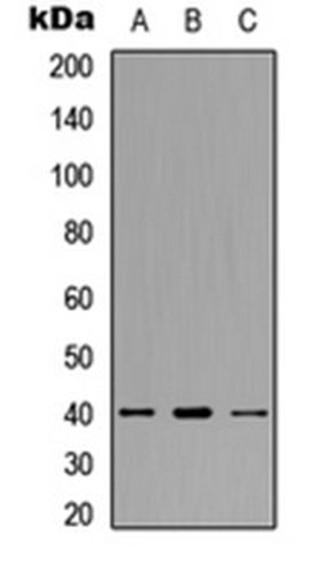 Western blot analysis of HeLa (Lane 1), SW480 (Lane 2), HepG2 (Lane 3) whole cell lysates using CCR11 antibody