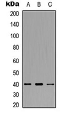 Western blot analysis of HeLa (Lane 1), SW480 (Lane 2), HepG2 (Lane 3) whole cell lysates using CCR11 antibody