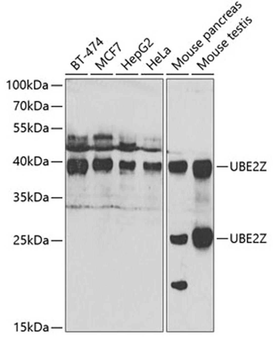 Western blot - UBE2Z antibody (A7225)