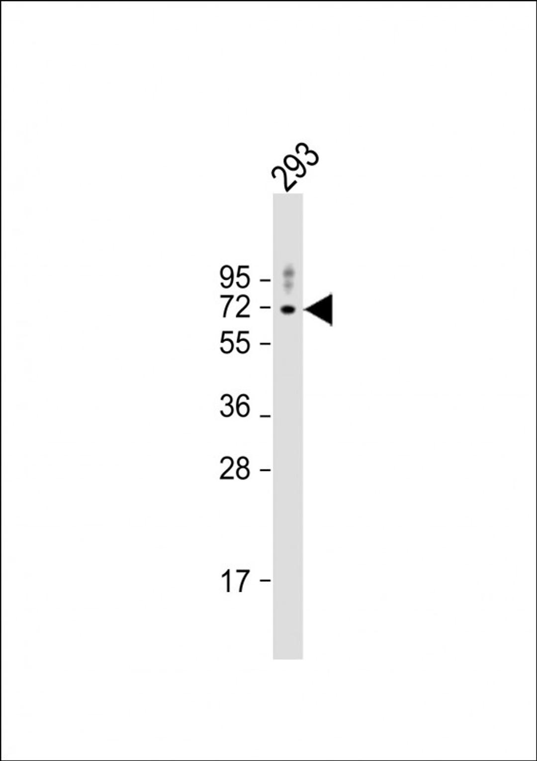 Western Blot at 1:1000 dilution + 293 whole cell lysate Lysates/proteins at 20 ug per lane.