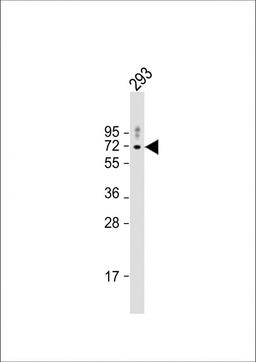 Western Blot at 1:1000 dilution + 293 whole cell lysate Lysates/proteins at 20 ug per lane.