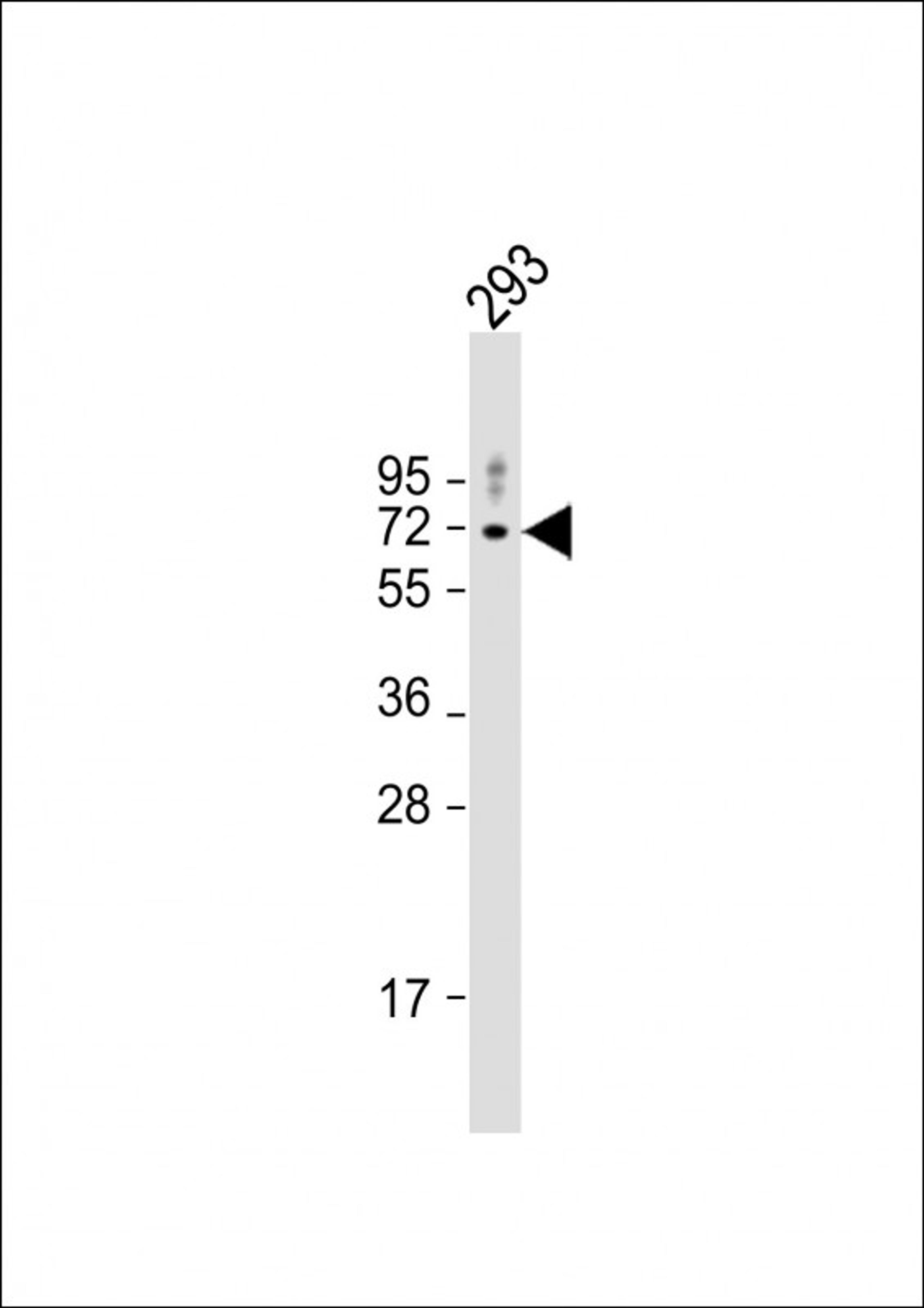 Western Blot at 1:1000 dilution + 293 whole cell lysate Lysates/proteins at 20 ug per lane.