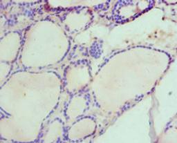 Immunohistochemistry of paraffin-embedded human thyroid tissue using CSB-PA010142ESR1HU at dilution of 1:100