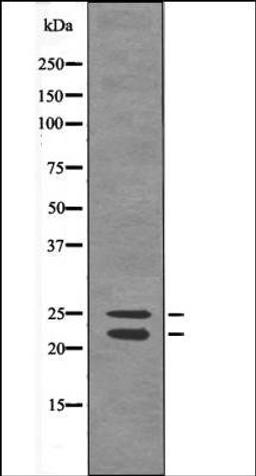 Western blot analysis of Sobital treated 293 whole cell lysates using Bim -Phospho-Ser44/104- antibody