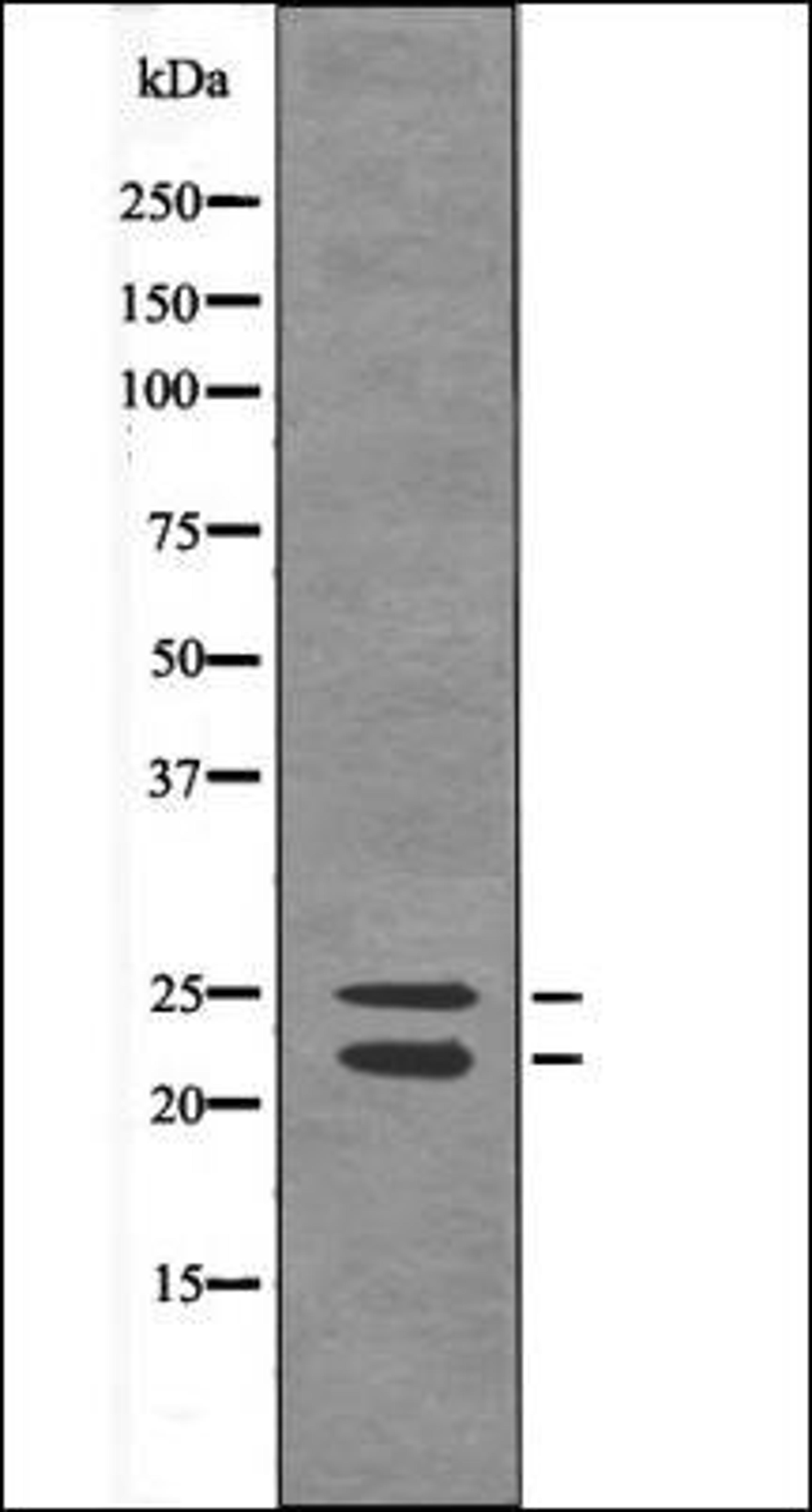 Western blot analysis of Sobital treated 293 whole cell lysates using Bim -Phospho-Ser44/104- antibody