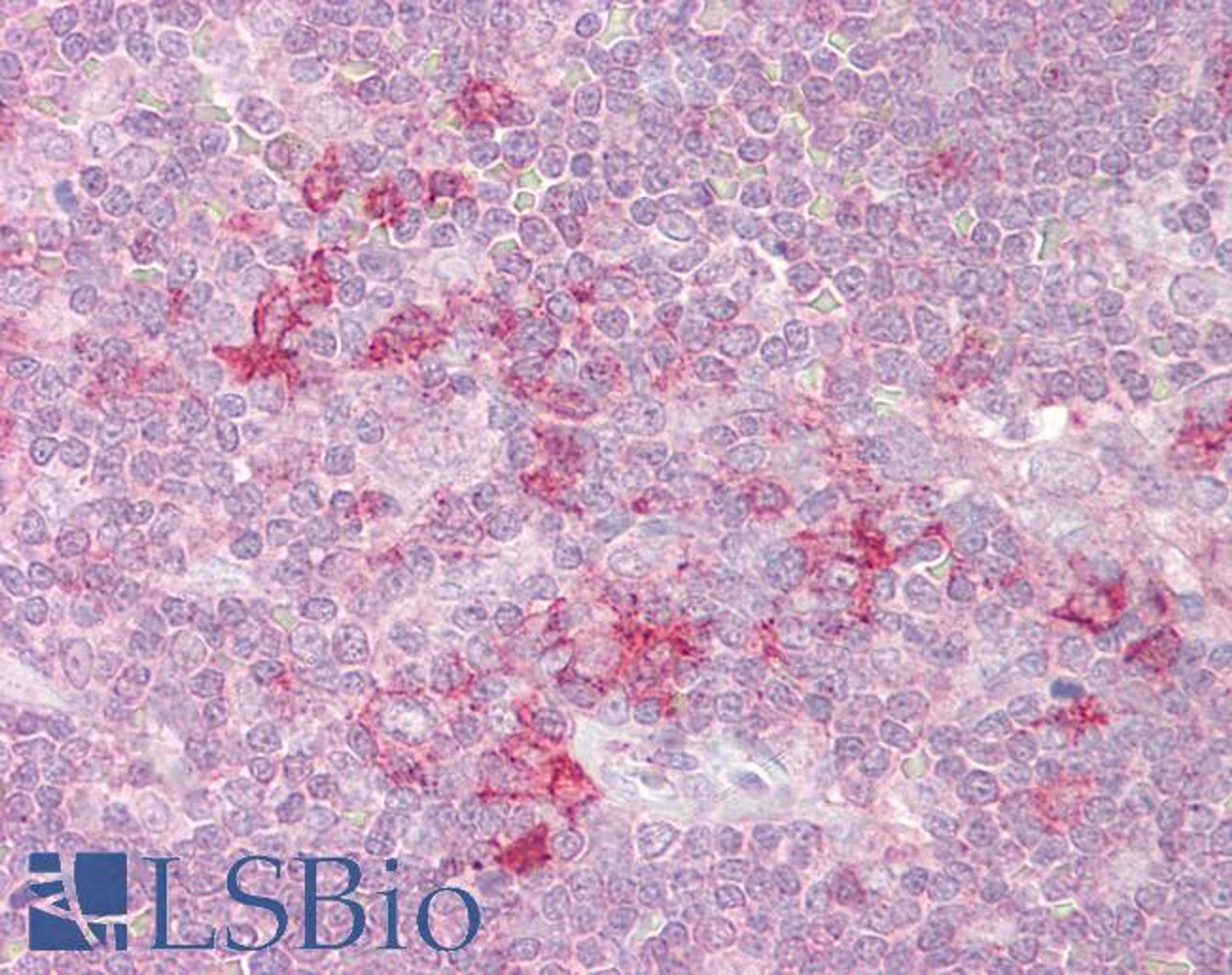 46-320 (2.5ug/ml) staining of paraffin embedded Human Thymus. Steamed antigen retrieval with citrate buffer pH 6, AP-staining.