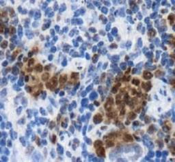 Immunohistochemistry: LOX Antibody [NB110-59729] - Staining of LOX in mouse spleen.