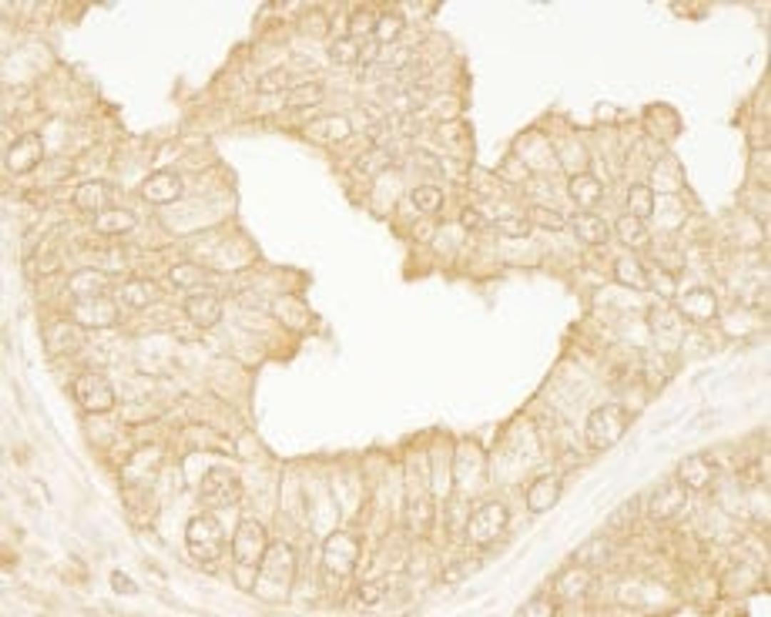 Detection of human PDZ-RhoGEF by immunohistochemistry.