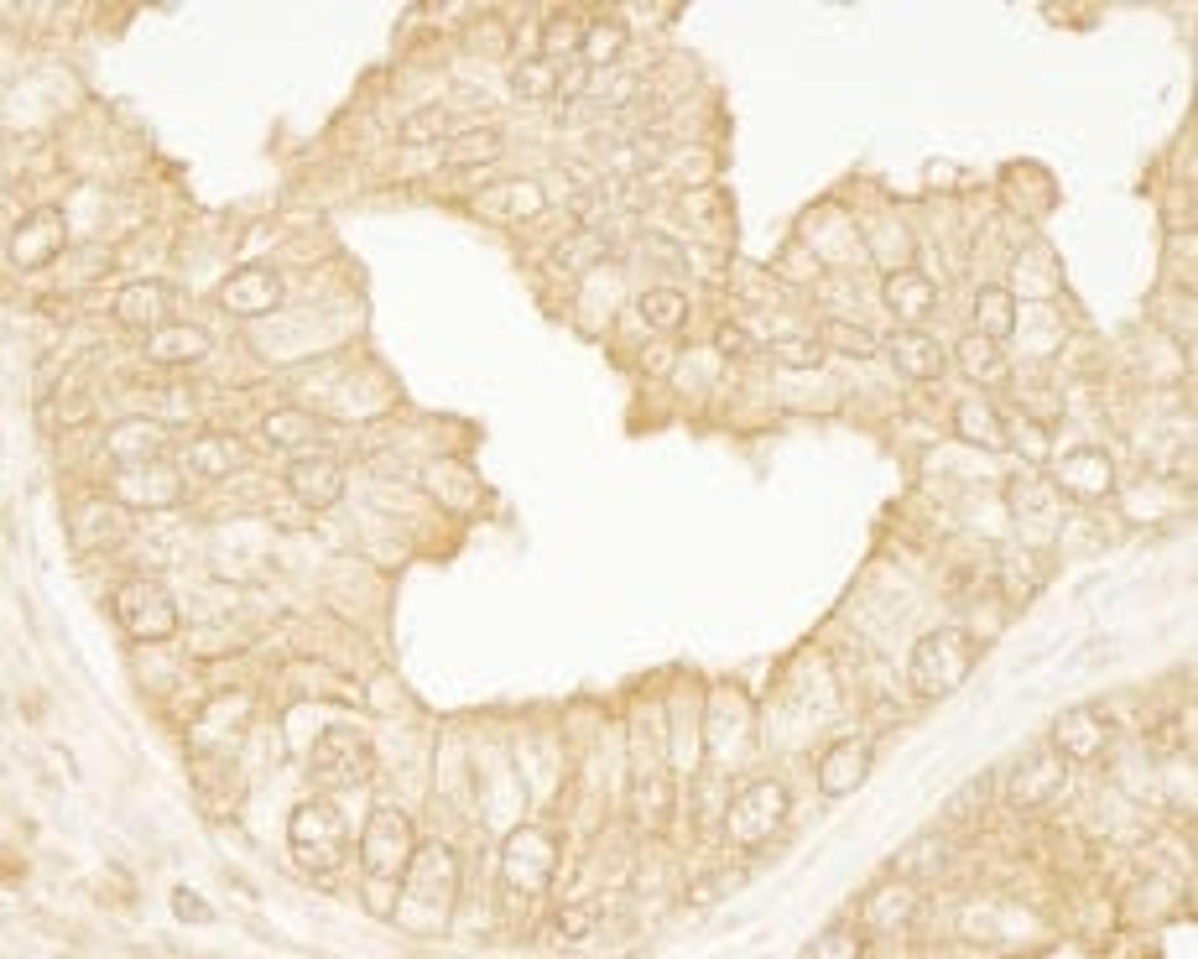 Detection of human PDZ-RhoGEF by immunohistochemistry.