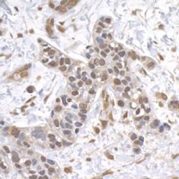 Detection of human USP1 by immunohistochemistry.