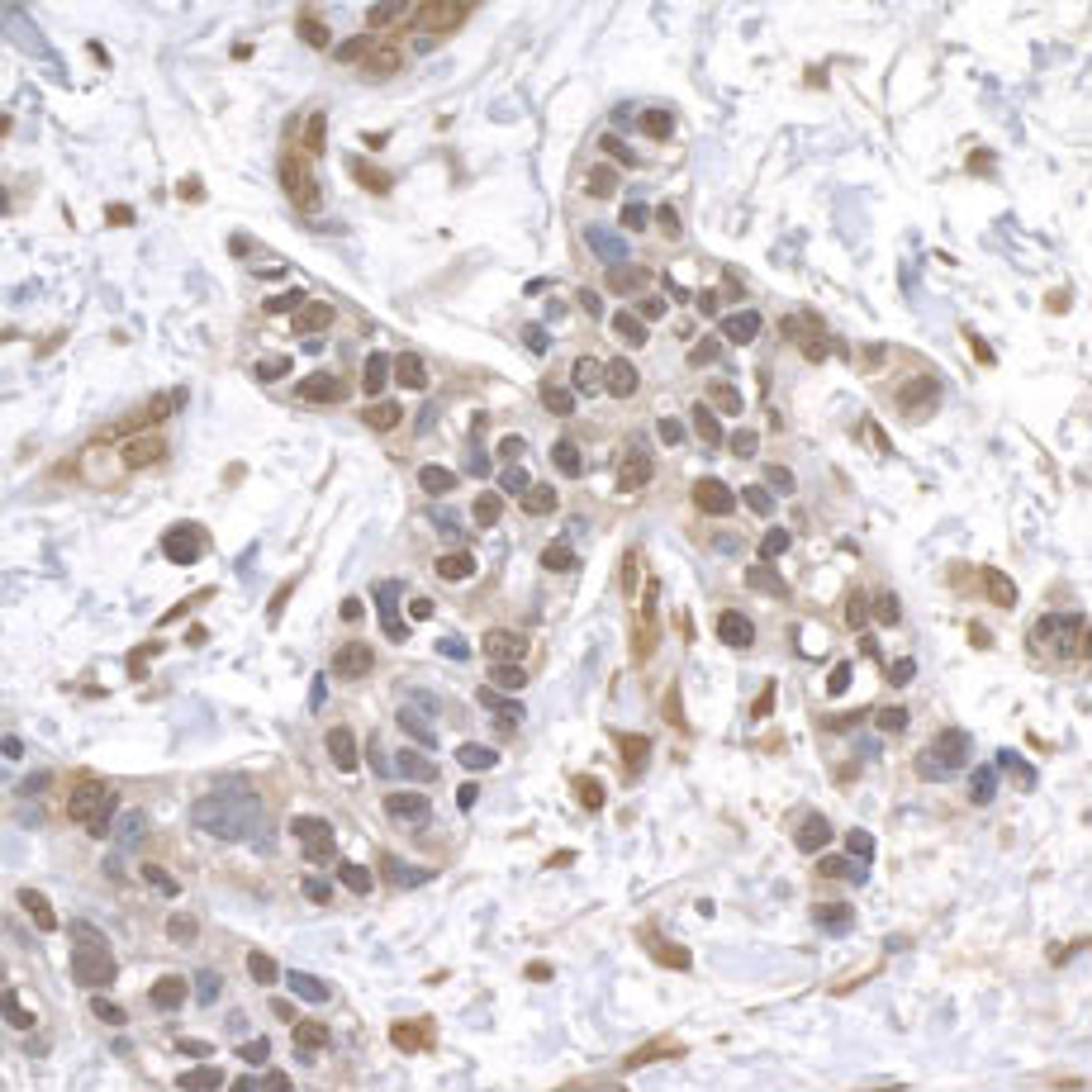 Detection of human USP1 by immunohistochemistry.