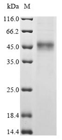 (Tris-Glycine gel) Discontinuous SDS-PAGE (reduced) with 5% enrichment gel and 15% separation gel.