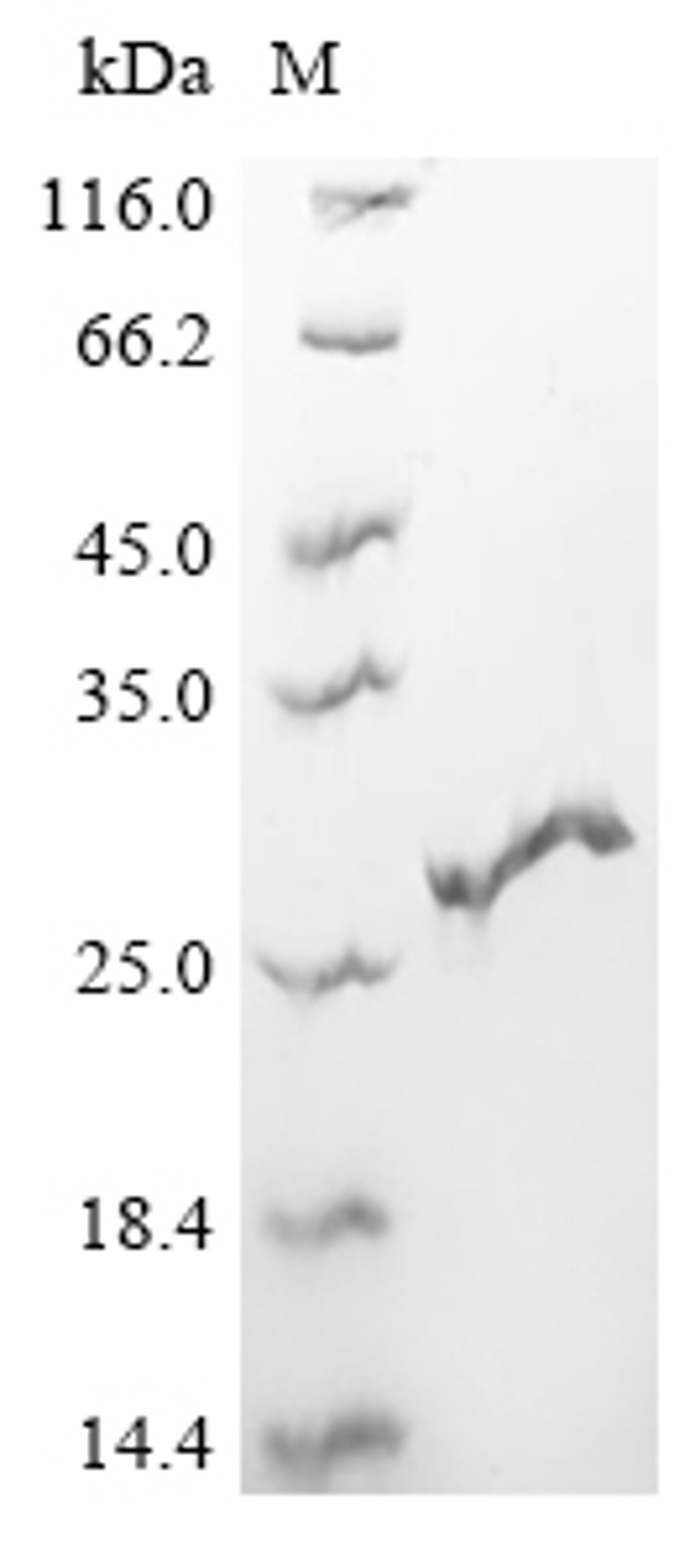 (Tris-Glycine gel) Discontinuous SDS-PAGE (reduced) with 5% enrichment gel and 15% separation gel.