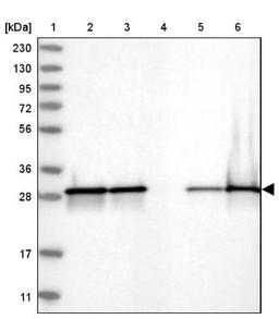 Western Blot: CACYBP Antibody [NBP1-87104] - Lane 1: Marker [kDa] 230, 130, 95, 72, 56, 36, 28, 17, 11<br/>Lane 2: Human cell line RT-4<br/>Lane 3: Human cell line U-251MG sp<br/>Lane 4: Human plasma (IgG/HSA depleted)<br/>Lane 5: Human liver tissue<br/>Lane 6: Human tonsil tissue