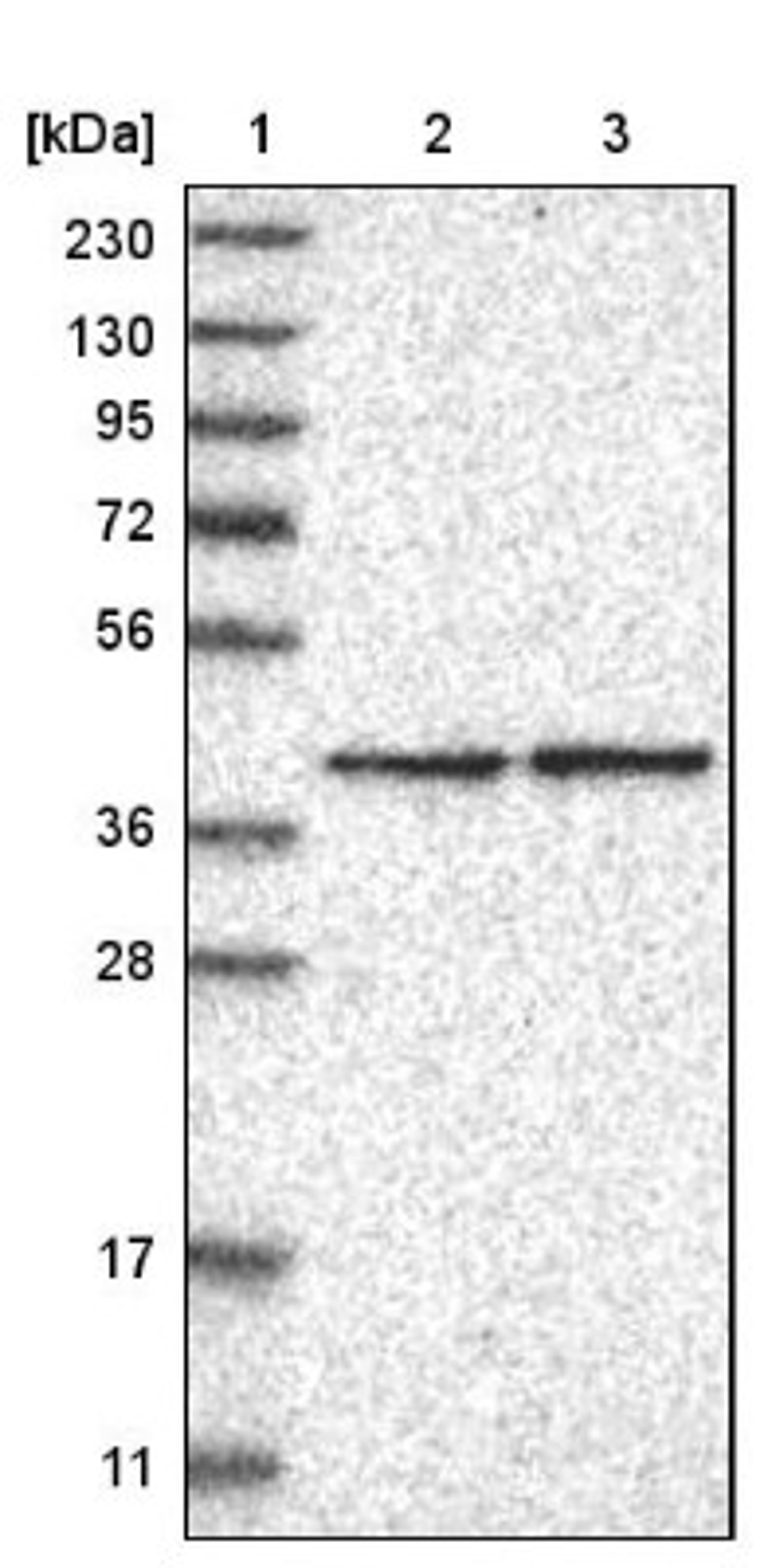 Western Blot: GTP binding protein era homolog Antibody [NBP1-89703] - Lane 1: Marker [kDa] 230, 130, 95, 72, 56, 36, 28, 17, 11<br/>Lane 2: Human cell line RT-4<br/>Lane 3: Human cell line U-251MG sp