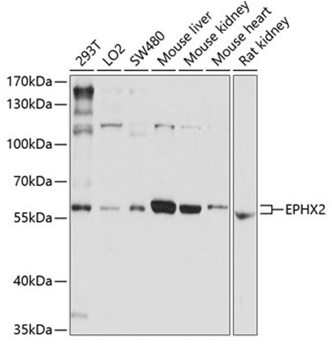 Western blot - EPHX2 antibody (A1885)