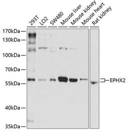 Western blot - EPHX2 antibody (A1885)