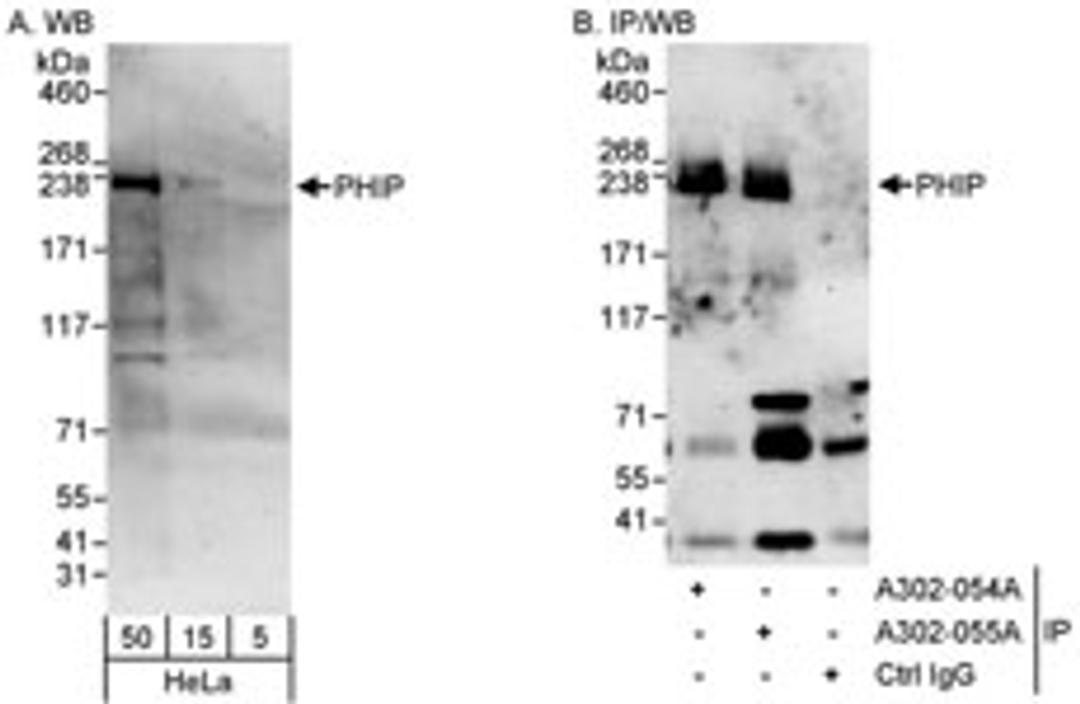 Detection of human PHIP by western blot and immunoprecipitation.