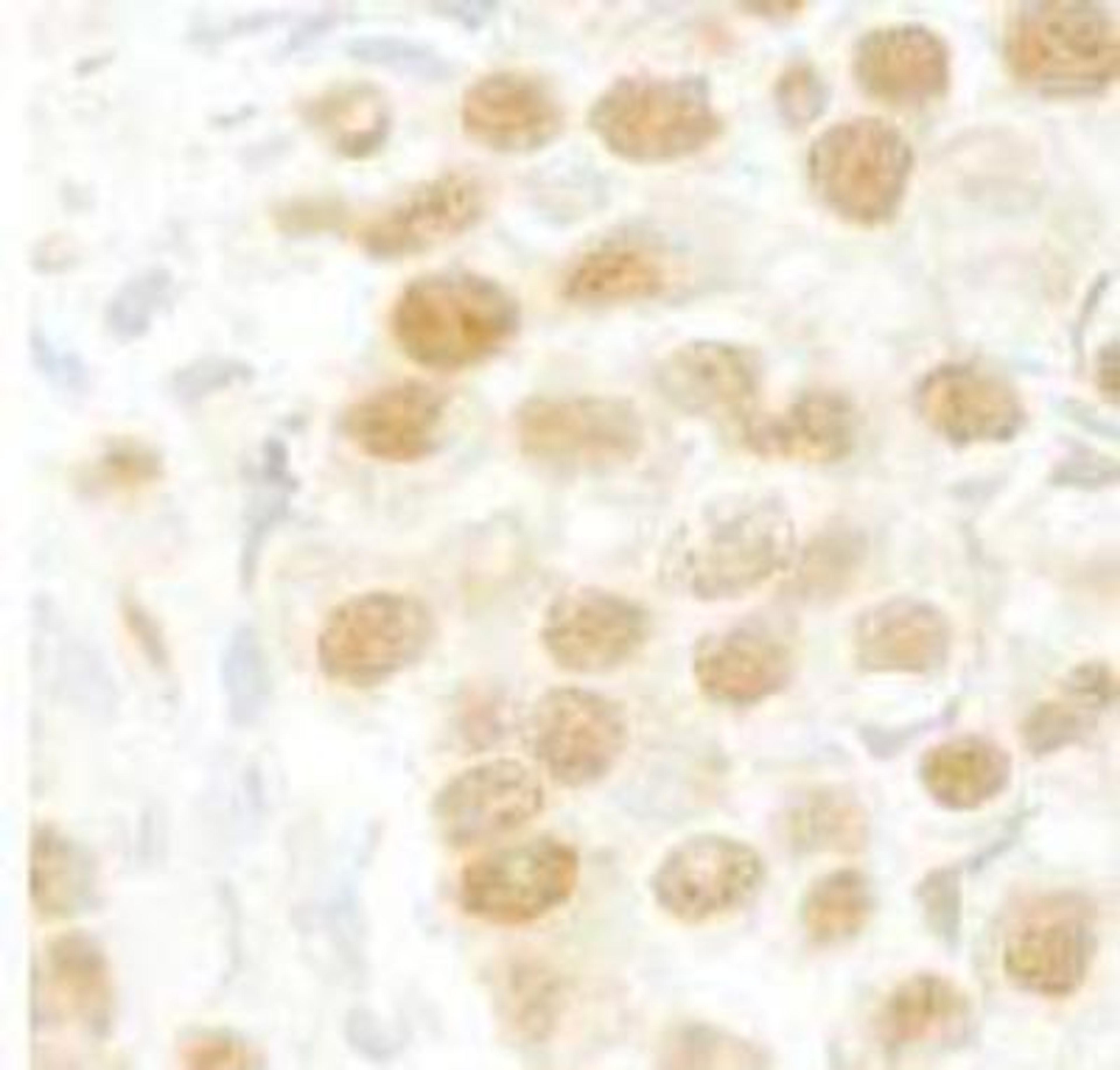 Immunohistochemistry-Paraffin: Caspase 11 Antibody [NB100-55266] - FFPE section of human seminoma.  Affinity purified rabbit anti-SFRS2IP used at a dilution of 1:100. Detection: DAB staining using Immunohistochemistry Accessory Kit