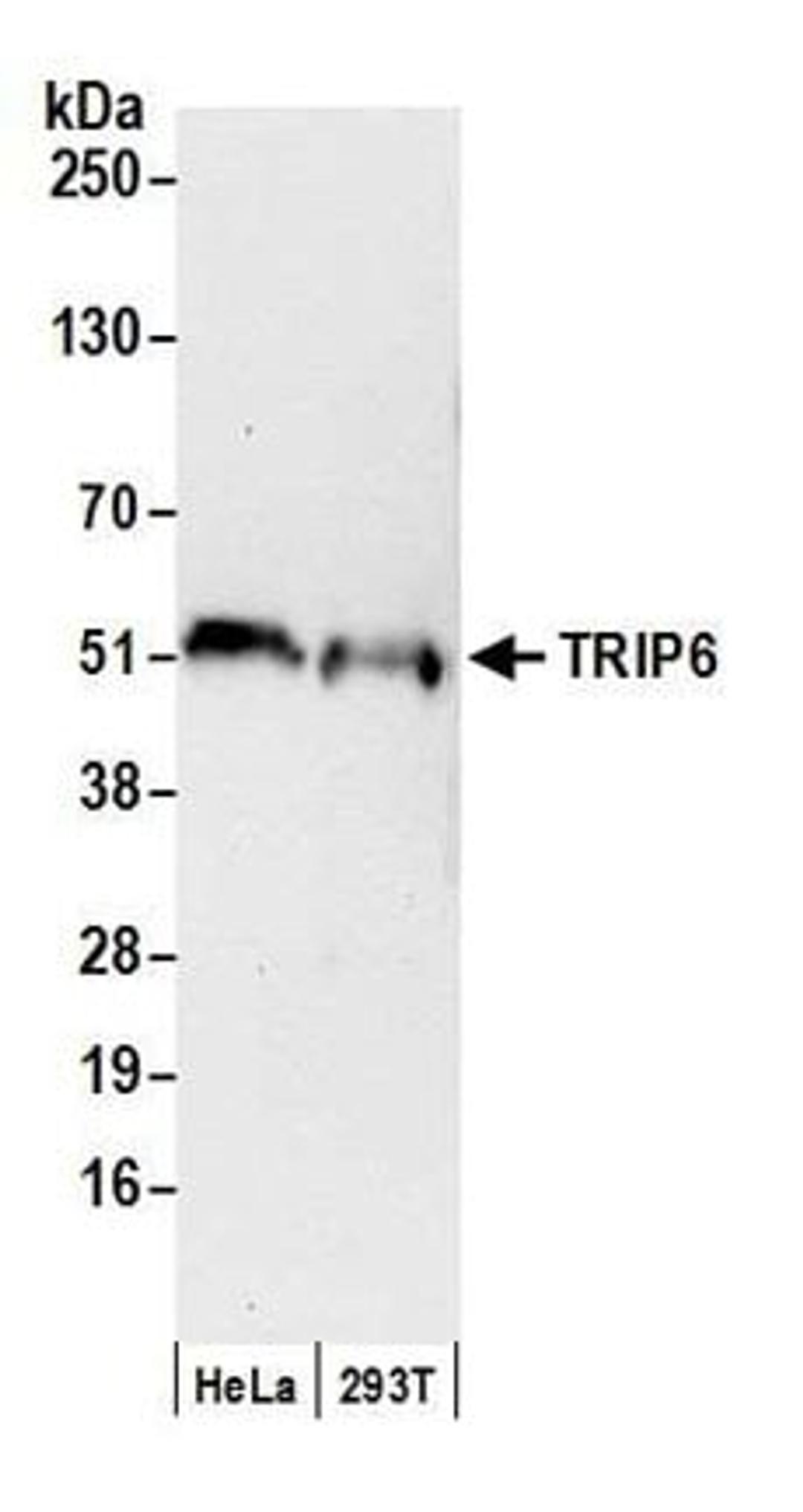 Detection of human TRIP6 by western blot.