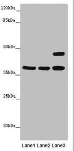 Western blot analysis of Thp-1(lane 1), K562(lane 2) whole cell lysate, Mouse brain tissue(lane 3) using MR1 antibody