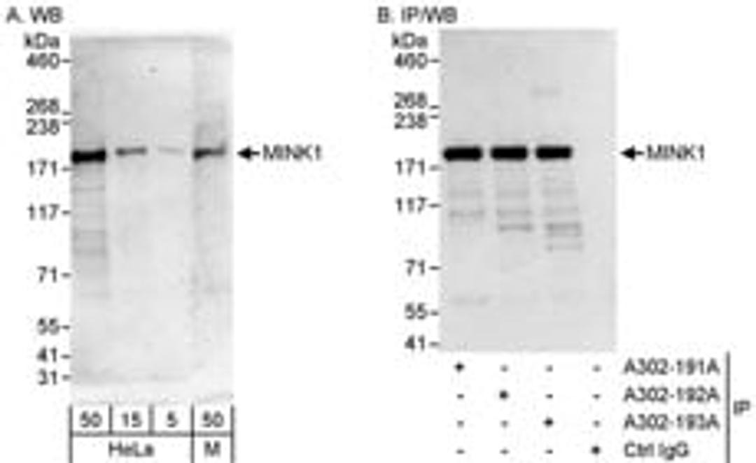 Detection of human and mouse MINK1 by western blot (h&m) and immunoprecipitation (h).