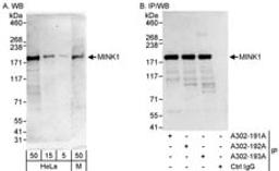 Detection of human and mouse MINK1 by western blot (h&m) and immunoprecipitation (h).