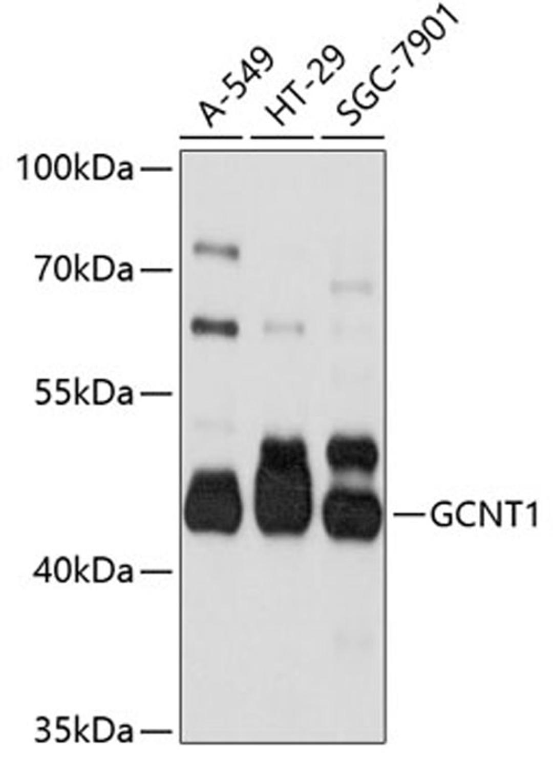 Western blot - GCNT1 antibody (A10842)