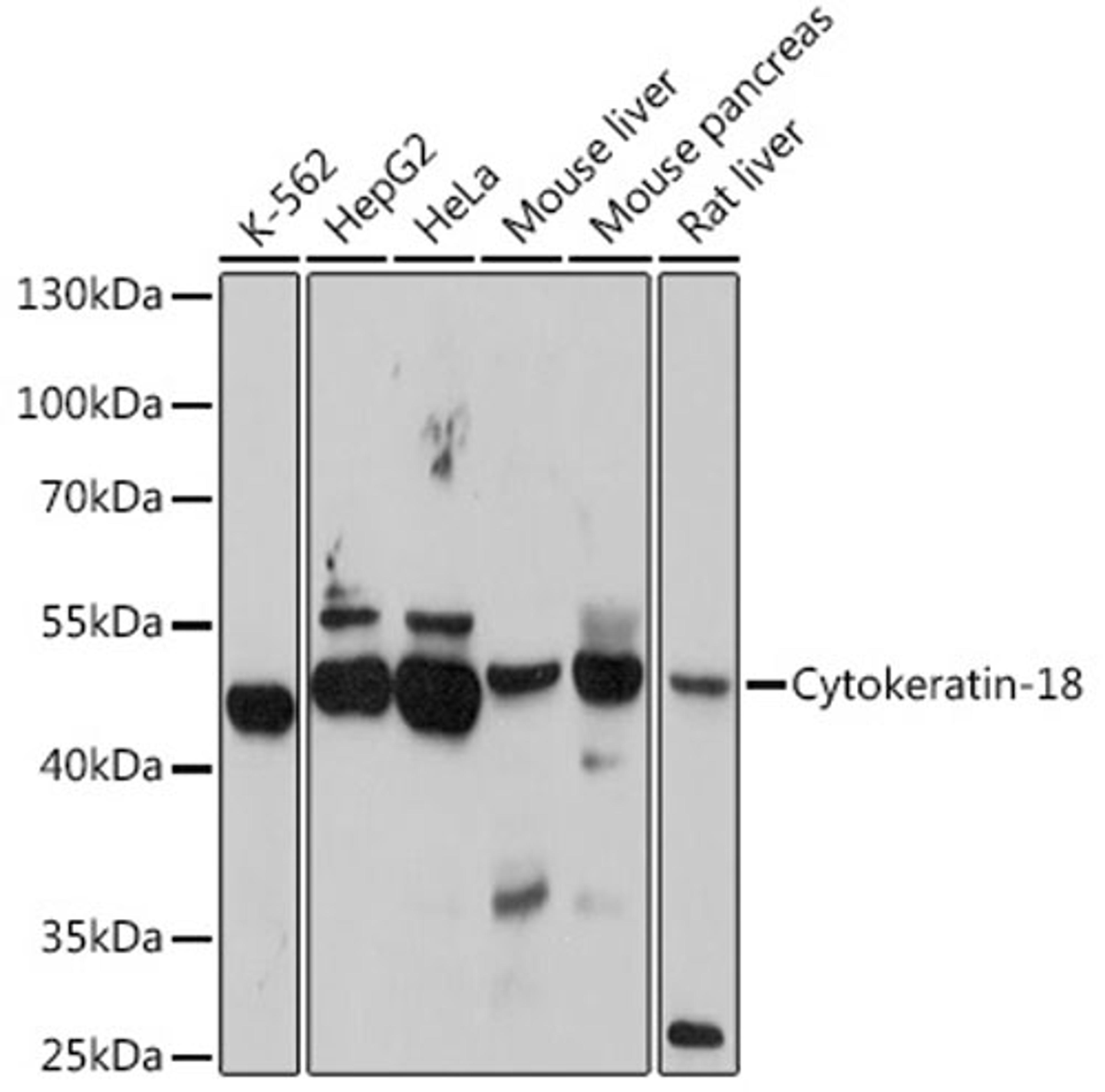 Western blot - Cytokeratin-18 antibody (A1022)