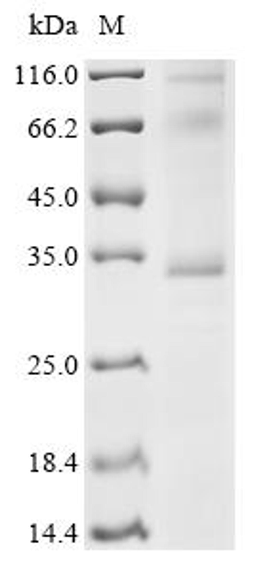 (Tris-Glycine gel) Discontinuous SDS-PAGE (reduced) with 5% enrichment gel and 15% separation gel.